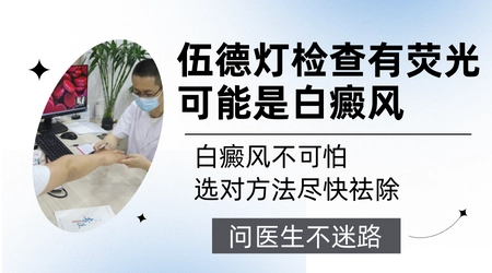 伍德灯下白斑显荧光就是白癜风吗