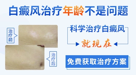 儿童胸部长一点点小块白斑