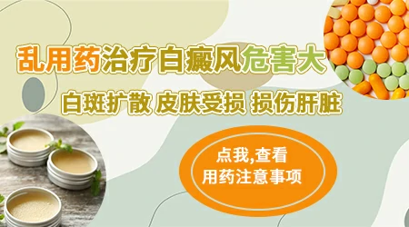 白癜风用什么药膏效果好