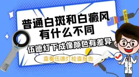 各种白斑早期症状图片大全