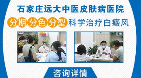 怎么判断白癜风是发展期还是稳定期