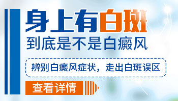 屁股上有个白的是不是白癜风