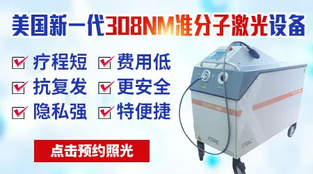 十一岁男孩脸上一块块白是怎么回事