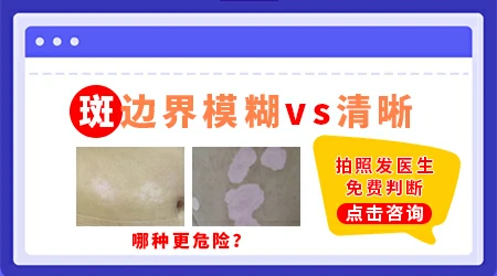 为什么白斑边界有时候清晰有时候模糊