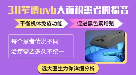 uvb治好白癜风还会复发吗