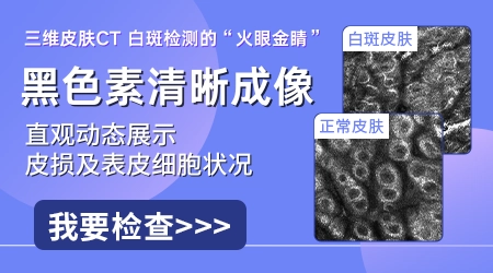 伍德灯结果显示亮白色荧光代表什么意思