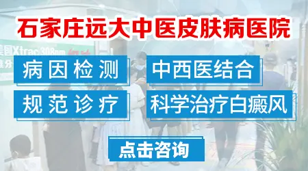石家庄白癜风专科医院哪家效果好