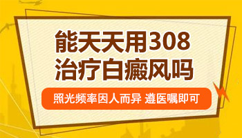 面部白癜风照308可以天天照吗