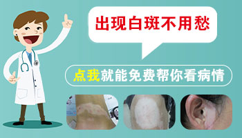 伍德灯下各种颜色的白斑代表什么