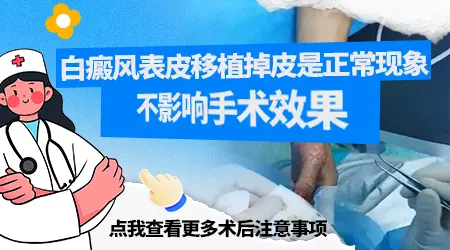 白斑表皮移植表皮多久脱落完