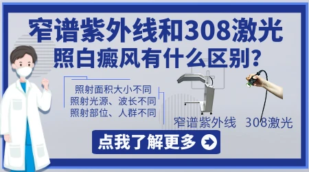 窄谱紫外线和308有什么区别 哪个能照好白癜风