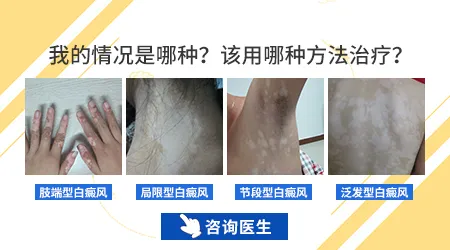 手脚上白癜风恢复的案例多不多