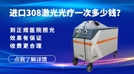 美国进口308激光照白癜风一个光斑大概费用多少