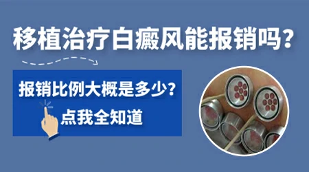 白癜风手术费用大概多少钱 医保能报销吗