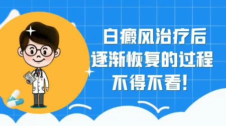 初期白癜风怎么治疗好得快