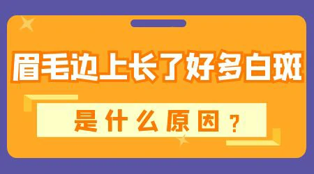 眉毛一圈的皮肤发白图片