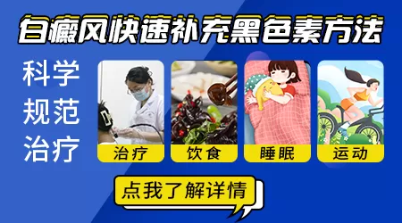 白癜风不治疗会怎么样会自愈吗