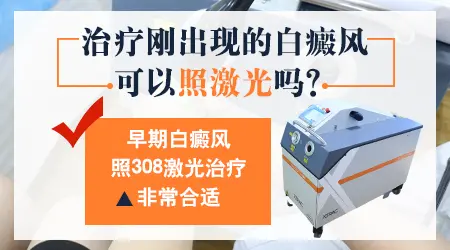 宝宝白癜风可以照光治疗吗