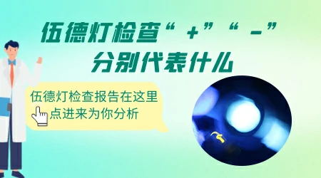 伍德灯下白斑加减号什么意思