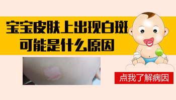 宝宝大腿内侧有白点什么情况