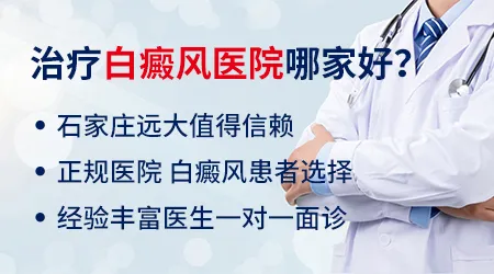 石家庄治疗白癜风专科医院哪家好