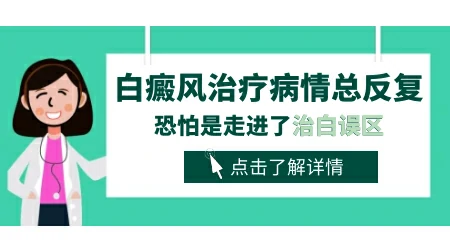 白癜风复发的几率大不大