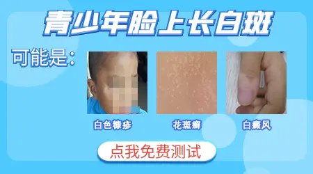 青少年脸上一块白是什么