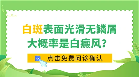 白斑表面光滑无屑就是白癜风吗