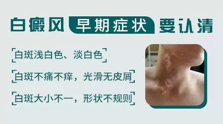 白癜风早期的症状表现都哪些