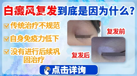 石家庄远大中医皮肤病医院植皮成功率高吗