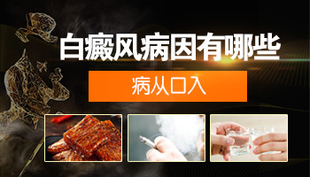 白癜风白斑不稳定不能照光吗