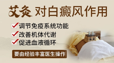 艾灸对白癜风的效果