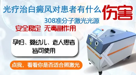 孕妇白斑可以接受308激光治疗吗