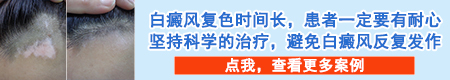 308准分子激光治疗白癜风后变红正常吗