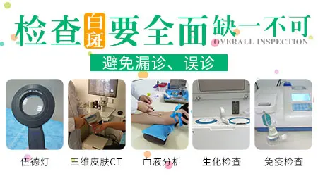 怎么去治疗皮肤白斑