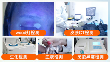 孩子下生后大腿根有白斑