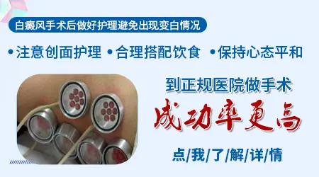 白斑手术后皮肤颜色能和正常皮肤一样吗