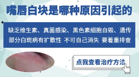 嘴唇边上有白色斑点怎么回事