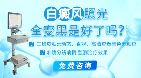 白斑照完激光皮肤发黑是怎么了