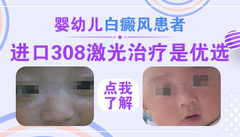 婴儿大腿有一块白斑怎么回事