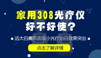 家用紫外线光疗仪治疗白癜风的效果怎么样