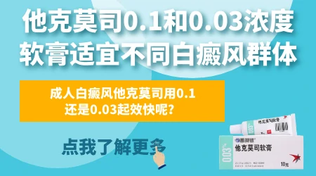 不同浓度的他克莫司软膏治疗白癜风怎么选