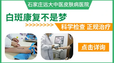 石家庄治疗白癜风康复率高的医院