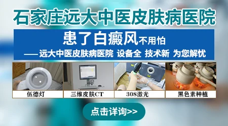 石家庄远大皮肤病医院治白癜风如何