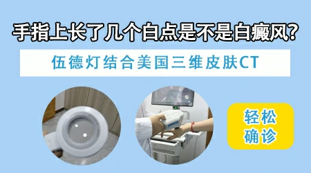 手指有一片白是怎么回事