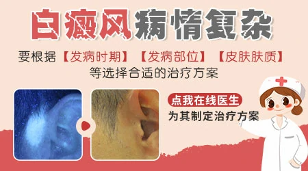 皮肤出现淡白色斑多久没扩散才算稳定
