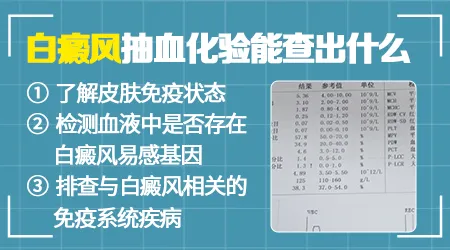 白斑初次就诊需要做哪些检查