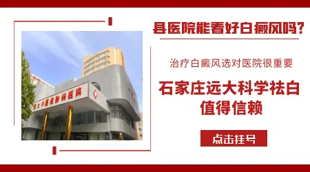 鼻子两边白癜风好治吗