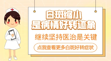 照光后白斑面积逐步缩小是好转吗