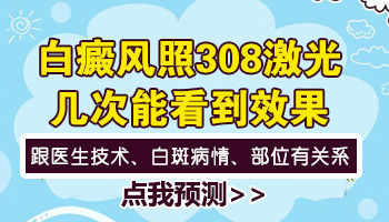 308激光对于治疗白癜风有用吗